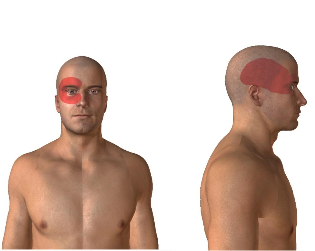 Lokalizacja klasterowego bólu głowy